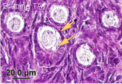 Ovaires de lapine: Follicules présentant des vacuoles (flèche orange) induites par le transport à T° ambiante