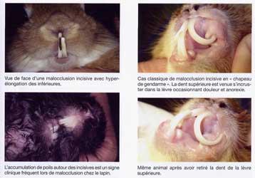 malocclusion incisives